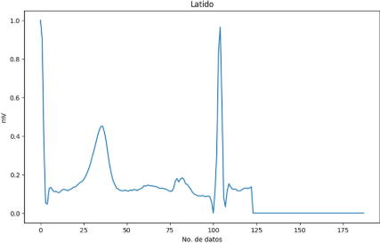 Clasificación de arritmias