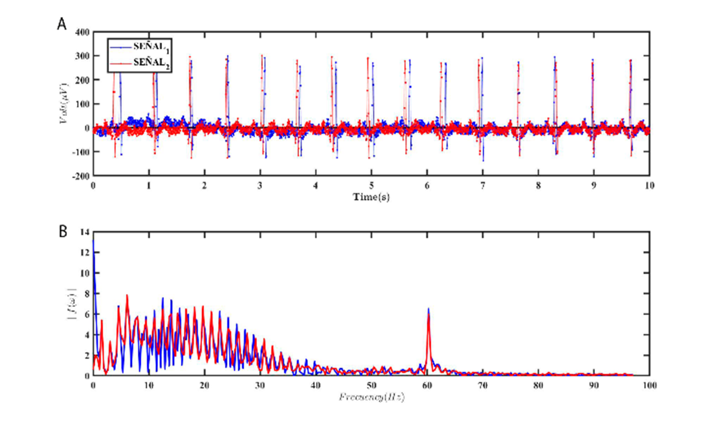 ECG Machine Learning